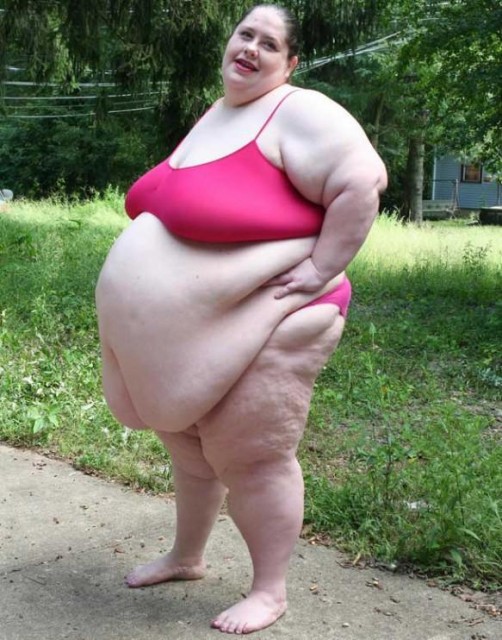 5.-Donna-Simpson-602-lbs.