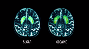sugar