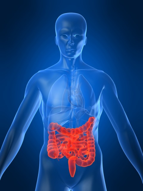 Colon-Cancer-l